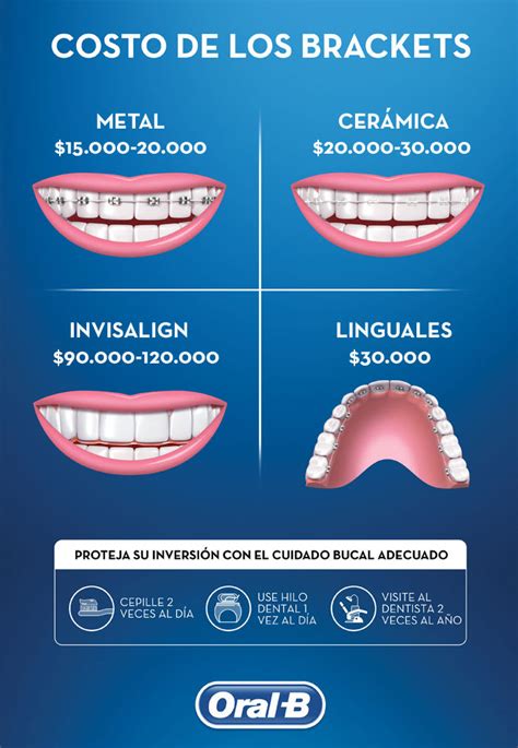 ortodoncia brackets metalicos precio|cuanto cuesta un bracket.